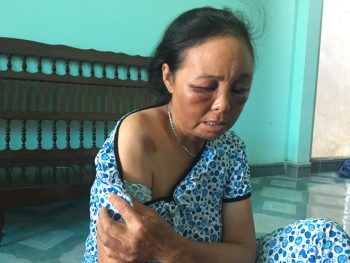 Người phụ nữ bị đánh vì nghi bắt cóc trẻ em: Tôi đã van xin rất nhiều lần nhưng họ không tha... - Ảnh 5.