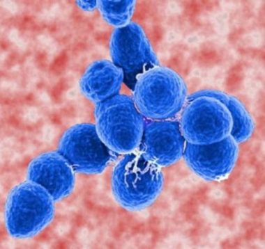 Streptoccocus pneumonia - Vi khuẩn thường gặp nhất trong VPCĐ.