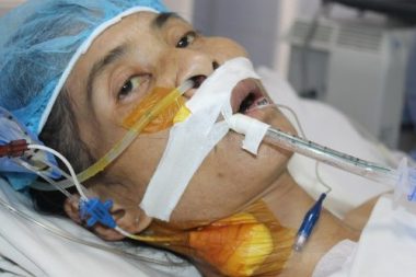Mẹ đơn thân người dân tộc Mường nguy kịch vì suy tim nặng - Ảnh 1.