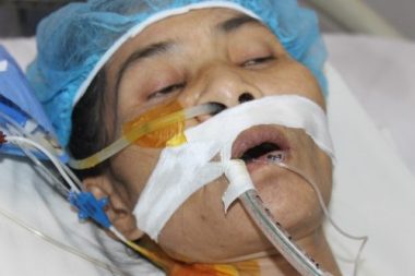 Mẹ đơn thân người dân tộc Mường nguy kịch vì suy tim nặng - Ảnh 3.