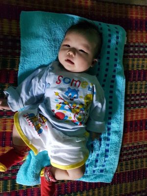 Dá» táº­t khÃ´ng lÃ¡ lÃ¡ch, tim báº©m sinh, bÃ© trai 4 thÃ¡ng nguy ká»ch - 2
