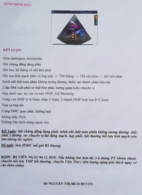 Dá» táº­t khÃ´ng lÃ¡ lÃ¡ch, tim báº©m sinh, bÃ© trai 4 thÃ¡ng nguy ká»ch - 3