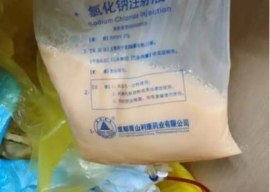 Túi mỡ 300ml lấy ra từ máu người đàn ông 47 tuổi chỉ vì hay ăn thực phẩm này