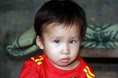 Tuá»i thÆ¡ khÃ´ng lÃ nh láº·n cá»§a 2 bÃ© miá»n quÃª nghÃ¨o HÃ  tÄ©nh, nguy cÆ¡ mÃ¹ vÄ©nh viá»n - 6