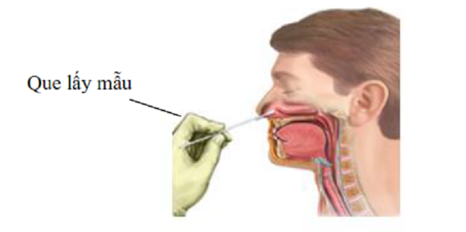 CDC: Những lưu ý khi tự test nhanh Covid-19 tại nhà để có kết quả chuẩn