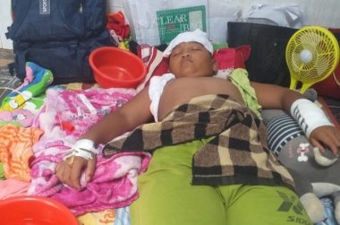 Thương cậu bé Khmer suýt chết mấy lần vì không có tiền chữa bệnh - 3