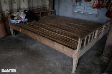 Cậu bé biến dạng khuôn mặt vì ngã vào nước nóng, gần 4 tuổi chưa biết nói - 5