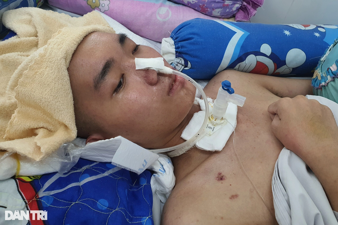 Nhận cuộc gọi bi kịch nhất đời, mẹ đau đớn để bác sĩ tháo sọ não con trai - 2