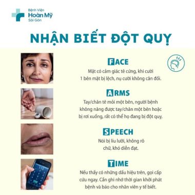 Tầm soát sớm để bảo vệ cơ thể trước nguy cơ đột quỵ - Ảnh 2.