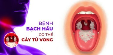 Làm gì để bảo vệ cả gia đình phòng ngừa bệnh Bạch hầu? - Ảnh 2.